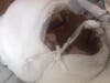 Miyah at the Children's Hospital of Michigan Burn Center
