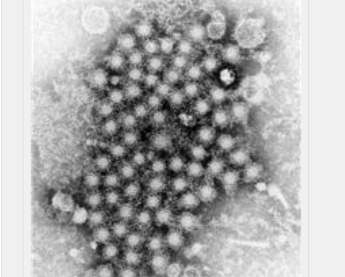 New Jersey health officials are warning about an outbreak of hepatitis A that's hit several counties hard.