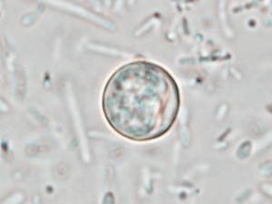 Cyclospora cayetanesis