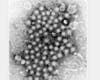 The disease has hit many counties hard, but hepatitis A has also popped up in unexpected places.