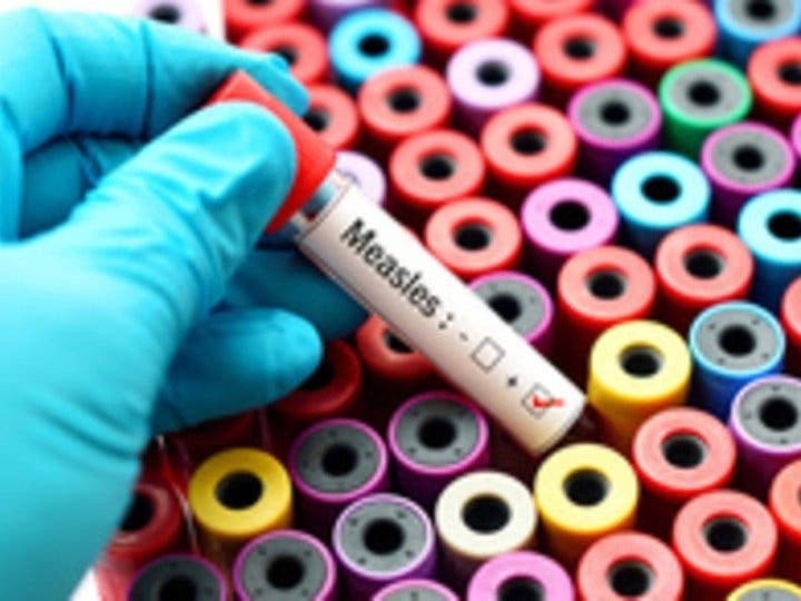 Measles is on the rise as fewer are getting vaccinated.