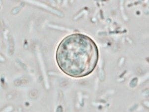 The Maryland Department of Health is investigating an increase in reported Cyclospora infections from multiple jurisdictions across the state.