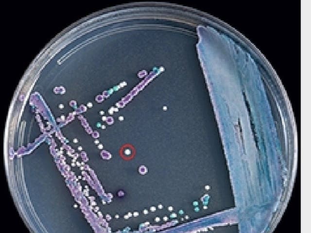 High-Quality Deadly 'superbug' Is Spreading Across Us As Drug Resistance Grows, Researchers Warn Picture for Your Screen High-Quality Deadly 'superbug' Is Spreading Across Us As Drug Resistance Grows, Researchers Warn Picture for Your Screen