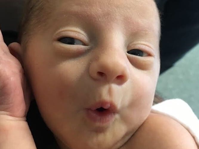 Toledo, Ohio, parents K.C. and Angela Ahlers are raising money so their son can get the medical treatment he needs. R.J. was born July 9 with two rare disorders, but the family's medical insurance doesn’t cover all the tests he needs.