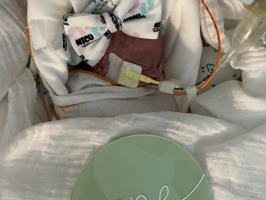 Sophie Jean Landuyt was born at 24 weeks on Sept. 16, 2022. 