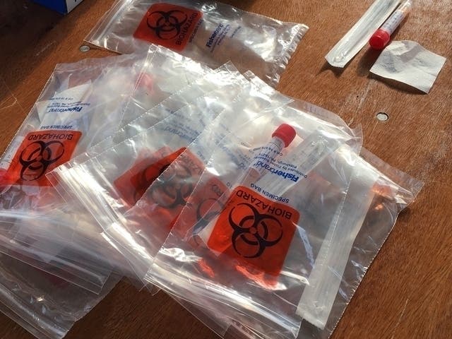 On Tuesday, officials reported 631 new cases, the largest one-day increase since the pandemic began in March.